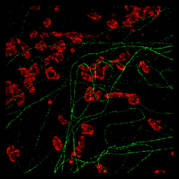 使用J9九游会642和532纳米激光器的基态耗尽显微术